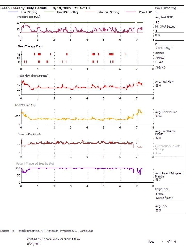 BiPap auto SV graphs - Help Please | CPAPtalk.com